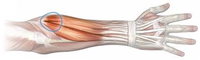 Tendons are delicate groups of connective tissue that append muscles to bones and enable joints to flex and broaden. Massage For Arm Wrist Pain Forearm Extensors