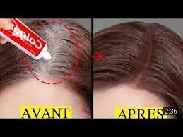 معجون الاسنان سيخلصك نهائيا وللابد من شيب الشعر واللحية والشيب المبكر علاج الشيب Youtube Beauty Recipes Hair Hair Care Oils Beautiful Skin Care