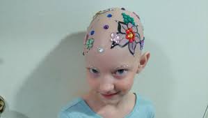 Fundraiser by Julianne Colburn : Kendall needs hip surgery