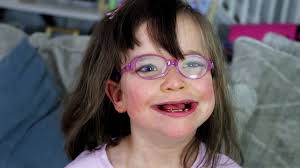 Isay recently survived a devastating anoxic brain injury that left him  unable to walk, talk, or care for himself. The injury drastically altered  his personality and turned his and his family's world