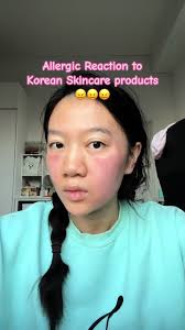 Korean Pharmacy Skincare for Hyperpigmentation but… i got an allergic  reaction #skincare #skincareroutine #koreanskincare #kbeauty  #hyperpigmentation #acnescars #tammyyin #acnefighter
