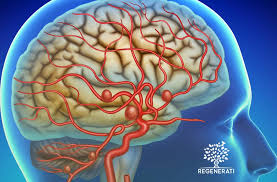 We did not find results for: Localizacao E Causas De Um Aneurisma Cerebral Clinica Regenerati