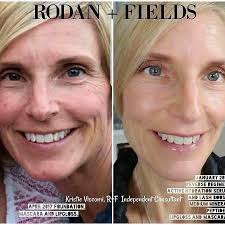 Healthy, glowing skin isn't just a dream 💛 With Derma Focus, enjoy smooth,  soft, and nourished skin all day long. Available at Shoprite — your skin's  new best friend is just a