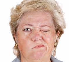 Bell's palsy impacts one side of the face, causing weakness and/or paralysis. Bells Palsy Canada Pdf Ppt Case Reports Symptoms Treatment