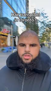 Reel by Omar Thaher (@_omarthaher) · November 28, 2025