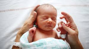 Image result for Neonatal Circumcision