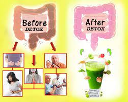 Cara merawati jangkitan kulat di kemaluan via nieyasweet.blogspot.com. Detox Dan Cuci Usus Sekiranya Anda Farmasi Medi Ehsan Facebook