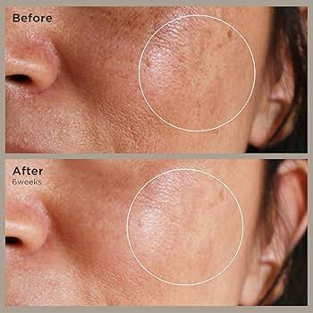 Nonapeptide-1 benefits