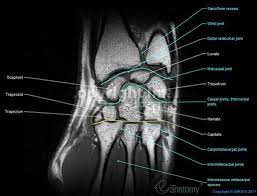 The intrinsic muscles are located within the foot and are responsible for the more fine motor actions of the foot, for example movement of individual digits. Mri Anatomy Wrist Hand Google Search Anatomy Images Radiology Anatomy