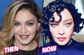 The stigma surrounding plastic surgery is disappearing as more mothers share their experiences, and why surgery was right for them. Madonna S Shocking Plastic Surgery Makeover Exposed By Top Docs