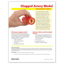 How do i know if i have clogged arteries. Clogged Artery Model English Spanish Health Edco Models