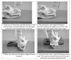 Simplified Positioning For Dental Radiology Dentalaire