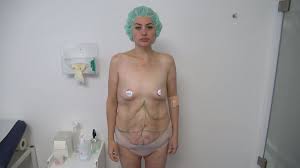 Aline bachmann nudes