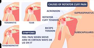 Together, you can determine whether cortisone shots may be a beneficial component in your overall treatment plan. Cortisone Shots In The Shoulder For Pain Allspine