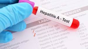 The virus is one of several types of hepatitis viruses that cause inflammation and affect your liver's ability to function. Hepatitis A Outbreak Update American Nurse