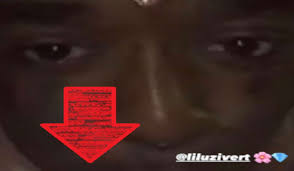 Jun 02, 2021 · lil uzi vert has removed the $24m (approximately £17m) diamond that was implanted in his forehead, three months after unveiling the ostentatious accessory. Lil Uzi Vert Gets 24 Million Rare Pink Diamond Implanted In His Forehead Like J A R V I S From Avengers Jordanthrilla