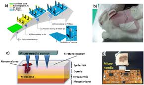 Lets have a look inside the freestyle libre sensor and what goes on inside. Skin In The Diagnostics Game Wearable Biosensor Nano And Microsystems For Medical Diagnostics Sciencedirect