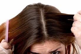 Free kutu rambut kepala 2 tips cara mengatasi masalah kutu kepala ubat kutu kepala mp3. Dua Maut Dua Kritikal Angkara Guna Racun Serangga Bunuh Kutu Ketahui Cara Sebenar Rawat Kutu Rambut Remaja