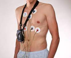 Langzeit Ekg Kardiologische Gemeinschaftspraxis