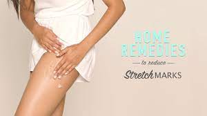 Following are natural remedies to remove stretch marks. How To Reduce Stretch Marks Diy Home Remedies Youtube