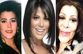 She had her fair share of being bullied but managed to pull through. Mexican Singer Alejandra Guzman Botchedsurgeries