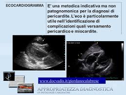 La diagnosi si basa sui sintomi e sui risultati dell' elettrocardiogramma ( ecg ), delle radiografie del torace o dell'ecocardiogramma. Il Dolore Toracico Ppt Scaricare