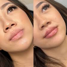 Life has been BUSY lately 🥲 Between moving houses, getting  @topicskincare.ca up and running, to still working 3-4 days per week  injecting, I'm just now getting back to my posting schedule 😂 ——————-