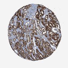 Atlas of the neonatal rat brain by ramachandra and subramanian describes rat brains at p1, p7 the series of atlases of the developing rat brain in stereotaxic coordinates that we propose here has. Tissue Expression Of Ass1 Staining In Kidney The Human Protein Atlas