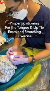 Image result for Lip Exam