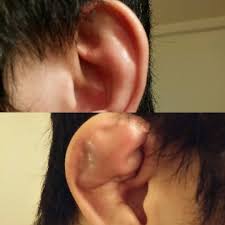That was unfortunately the reality of one fight at saturday's ufc fight night in las vegas. Why Do Most Mma Fighters Have Disfigured Ears Quora