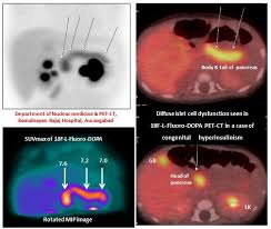 The pet scan is very similar to a ct or mri scan. Dr Sellam Karunanithi Md Aiims Fanmb Febnm Consultant And Hod Aster Mims Linkedin