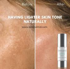 Make Skin Lighter Shop Light Skin Tone Lightening Serum Skin Lightening Serum