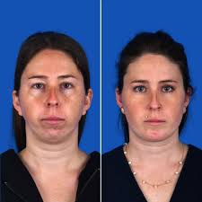 Dr. Steven Sherry (@drsherryoralsurgery) • Instagram photos and videos