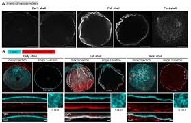 Maybe you would like to learn more about one of these? Actin Assembly Ruptures The Nuclear Envelope By Prying The Lamina Away From Nuclear Pores And Nuclear Membranes In Starfish Oocytes Elife