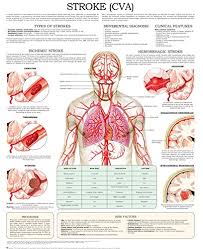 amazon com stroke cva e chart quick reference guide