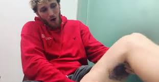 Meanwhile, jake treated this like a game of cat and mouse as he happily called out, let's go baby! What Happened To Logan Paul S Leg His Bruises Are Alarming Us