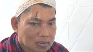 វ័យ៤៥ឆ្នាំ មិនធ្លាប់ម៉ែវាយ ពួកម៉ាកមិនធ្លាប់វាយ១ដៃ តែពេលនេះ  ខ្ញុំមានរបួសពេញ១តួខ្លួន ជីវិតស្ទើរតែបាត់បង់ បានគុណទឹកដោះម្តាយថ្លៃ ទើប ...