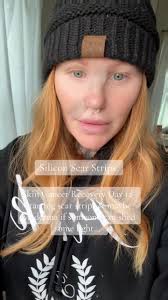 Desiree Noel Apology