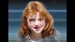 Parents Claim Vaccines Caused Daughter's Autism