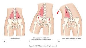 Blood vessels and nerves of the hip How Can Tight Muscles Of The Hip Joint Cause A Scoliosis
