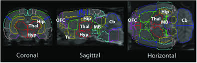 An rna seq atlas of gene expression. Sectional Views Of Schiffer And Colleagues Rat Brain Region Of Download Scientific Diagram