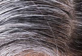 Questa spezia è utile per combattere la perdita di memoria, e per prevenire l’alzheimer, lottando contro le infiammazioni. Capelli Bianchi Grigi Come Contrastare L Invecchiamento Con Impacchi A Base Di Chiodi Di Garofano E Alloro Video