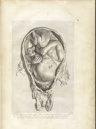 Historical Anatomies On The Web William Hunter Home Anatomy Art Art Drawings