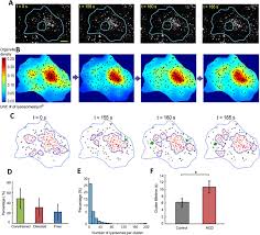 We did not find results for: Whole Cell Scale Dynamic Organization Of Lysosomes Revealed By Spatial Statistical Analysis Biorxiv