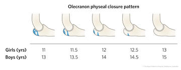 fracture education remodelling