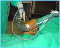 Download 鼓楼医院骨关节门诊患 and enjoy it on your iphone, ipad, and ipod touch. éª¨ç§' åœ‹è»è‡ºä¸­ç¸½é†«é™¢å…¨çƒè³‡è¨Šç¶²