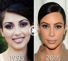 • kim kardashian | before and after transformations here's her before and after transformation, including possible plastic surgery. This Item Is Unavailable Etsy In 2021 Kim Kardashian Before Plastic Surgery Photos Celebrity Plastic Surgery