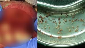 Sakit dada sebelah kiri biasanya merupakan gejala serangan jantung. Bibir Bengkak Terasa Gerak Gerak Saat Dibedah Isinya Mengejutkan Kurio