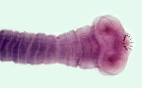 Image result for Beef Tapeworm