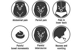 Typically, the pain is felt in the pelvis, abdomen, or lower back. Why Ovarian Cysts Are A Cause For Concern Health Plus